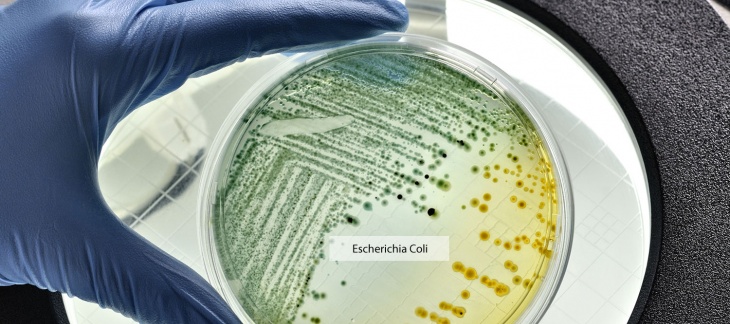 Intoxication alimentaire à Escherichia Coli : non merci !